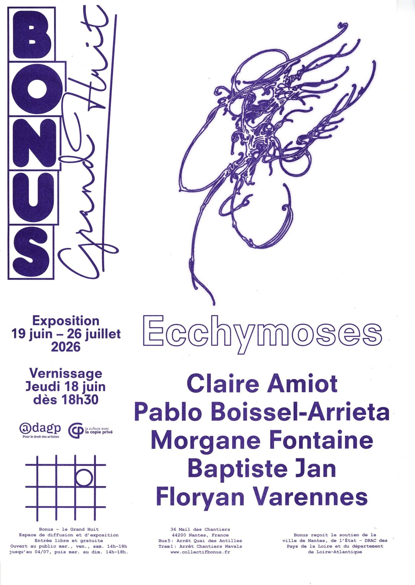 Ecchymoses
